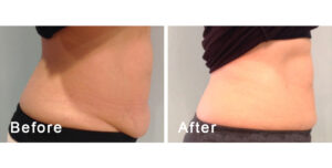 BodyFX