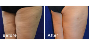 BodyFX