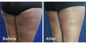 BodyFX