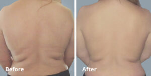 BodyFX