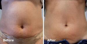 BodyFX