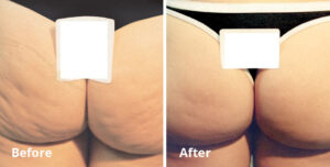 BodyFX
