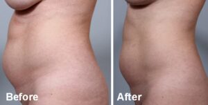 BodyFX