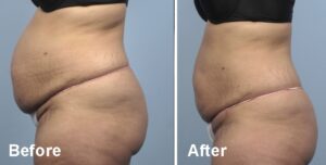 BodyFX