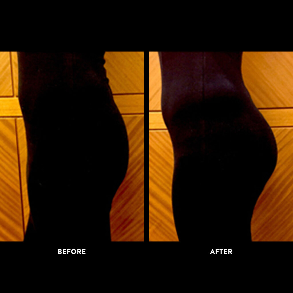 bbl before & after